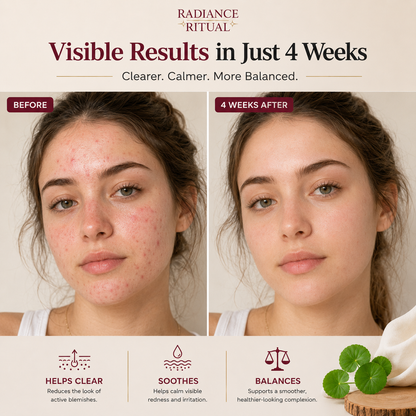 DermaGlow™- For Redness & Flushing