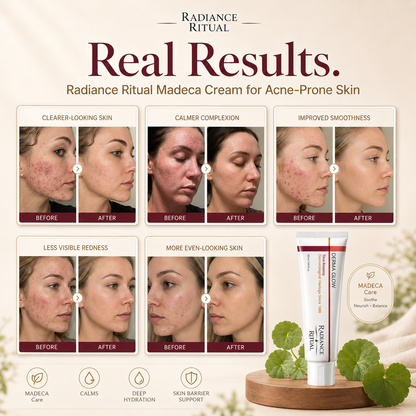 DermaGlow™- For Redness & Flushing