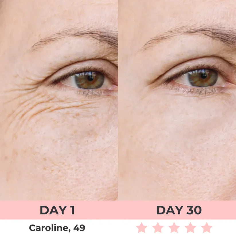 Red Light Therapy Face Sculptor