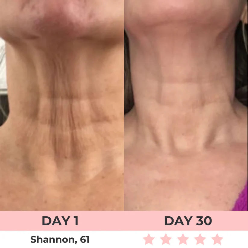 Red Light Therapy Face Sculptor